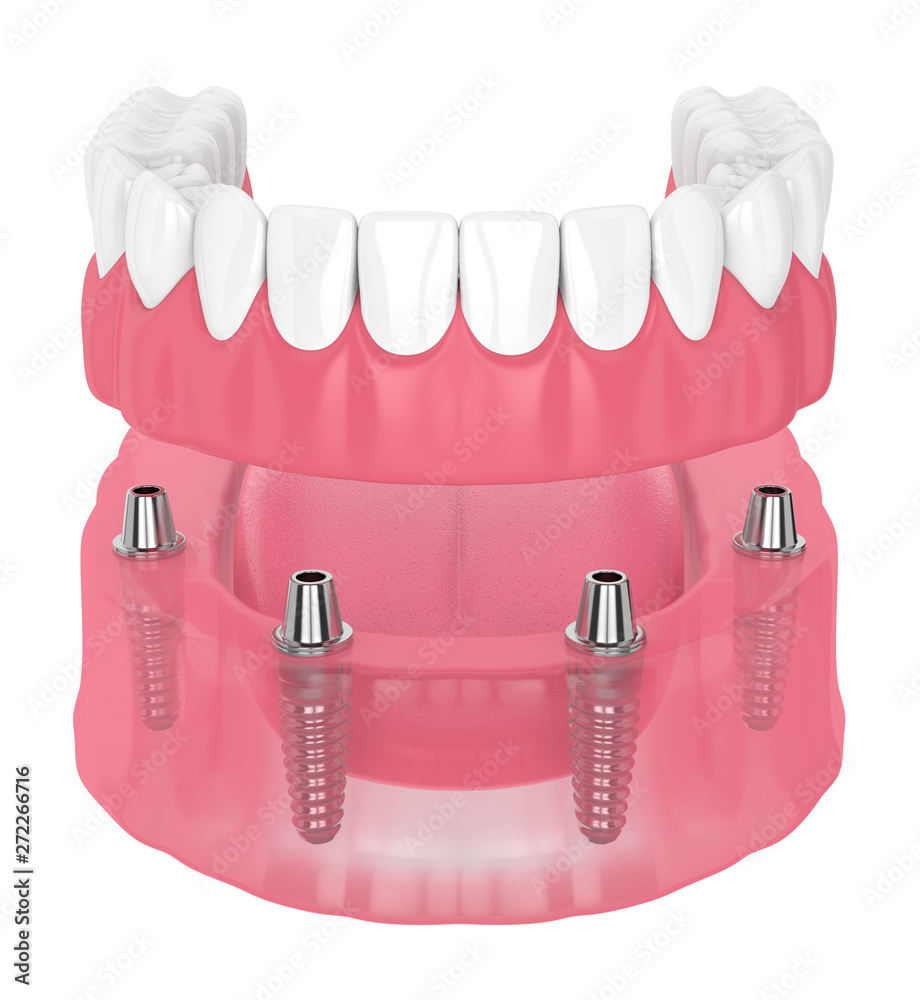 AdobeStock_272266716_Preview